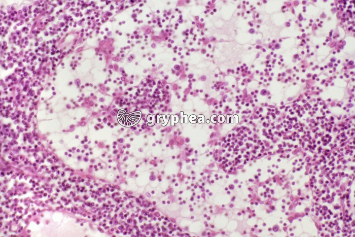 Ganglion lymphatique x100 - gryphea.com